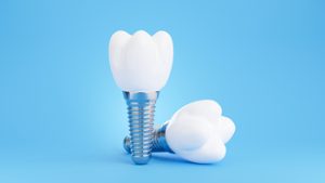 implant dentist abroad coorparoo