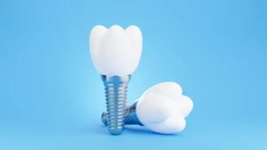 Two dental implants resembling white teeth with metal bases are positioned against a bright blue background, creating a clean, clinical look.