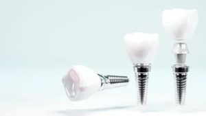 Three dental implants with shiny silver bases and white tooth crowns on a light background. One lies flat, while two stand upright, conveying care and precision.