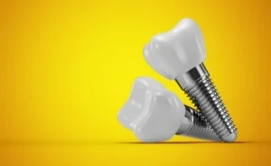 Two dental implants with metallic screws and white ceramic crowns are positioned against a bright yellow background, highlighting their sleek design.