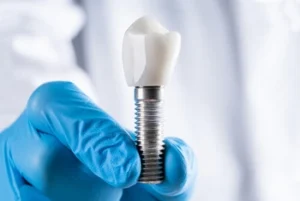 A gloved hand holds a dental implant with a metal screw base and a white ceramic tooth, against a blurred white background, indicating a clinical setting.