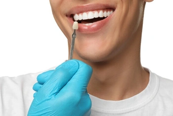 A person smiling as a gloved hand holds a dental veneer sample near their teeth, suggesting a dental treatment or cosmetic procedure.