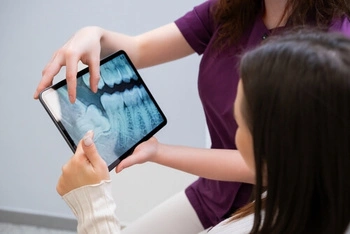 Two people review dental X-rays on a tablet. One points to the image, suggesting discussion. The setting appears clinical and focused.