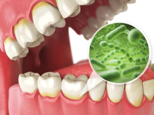 sudden bad breath in toddlers bacteria