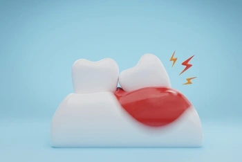 Two cartoonish teeth with a red, inflamed gum area between them on a light blue background. Yellow lightning bolts indicate pain or discomfort.